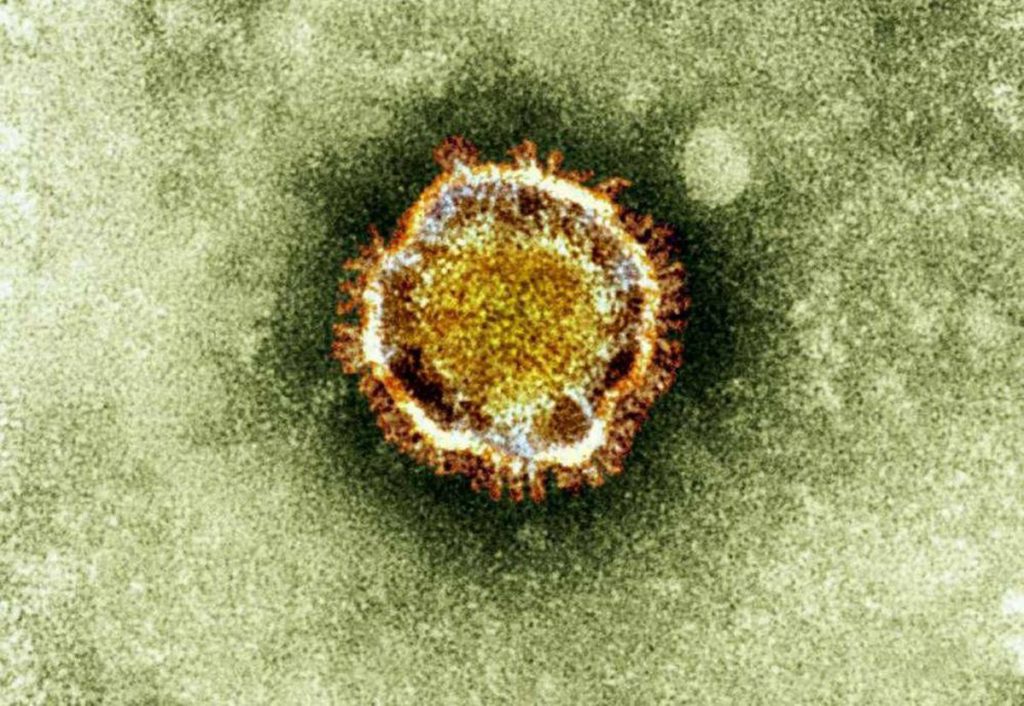 Laboratório canadense adquire amostra de coronavírus