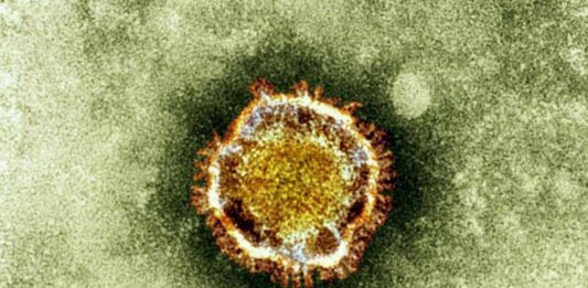 Canadian Lab Acquires Coronavirus Sample