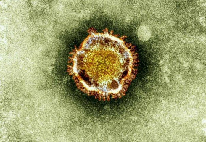 Canadian-Lab-Acquires-Coronavirus-Sample-696x480.jpeg