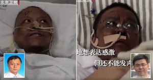 Two Chinese Doctors Turn Black After Recovering From COVID-19