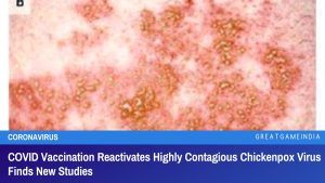 COVID Vaccination Reactivates Highly Contagious Chickenpox Virus Finds New Studies