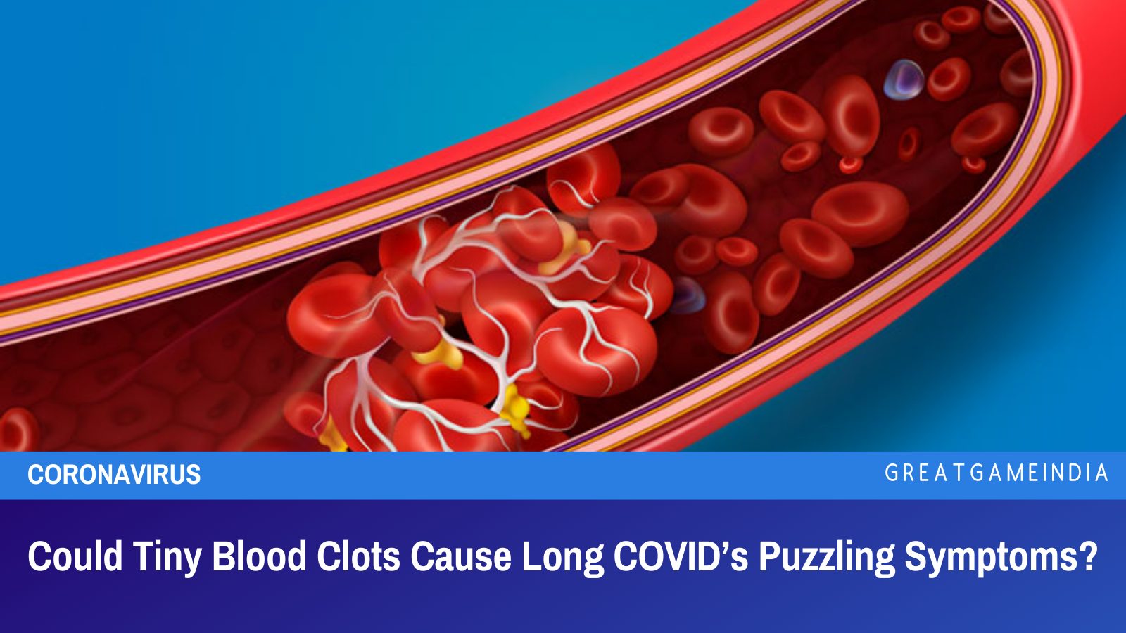 Could Tiny Blood Clots Cause Long COVID s Puzzling Symptoms could-tiny-blood-clots-cause-long-covid-s-puzzling-symptoms
