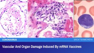 Vascular And Organ Damage Induced By mRNA Vaccines