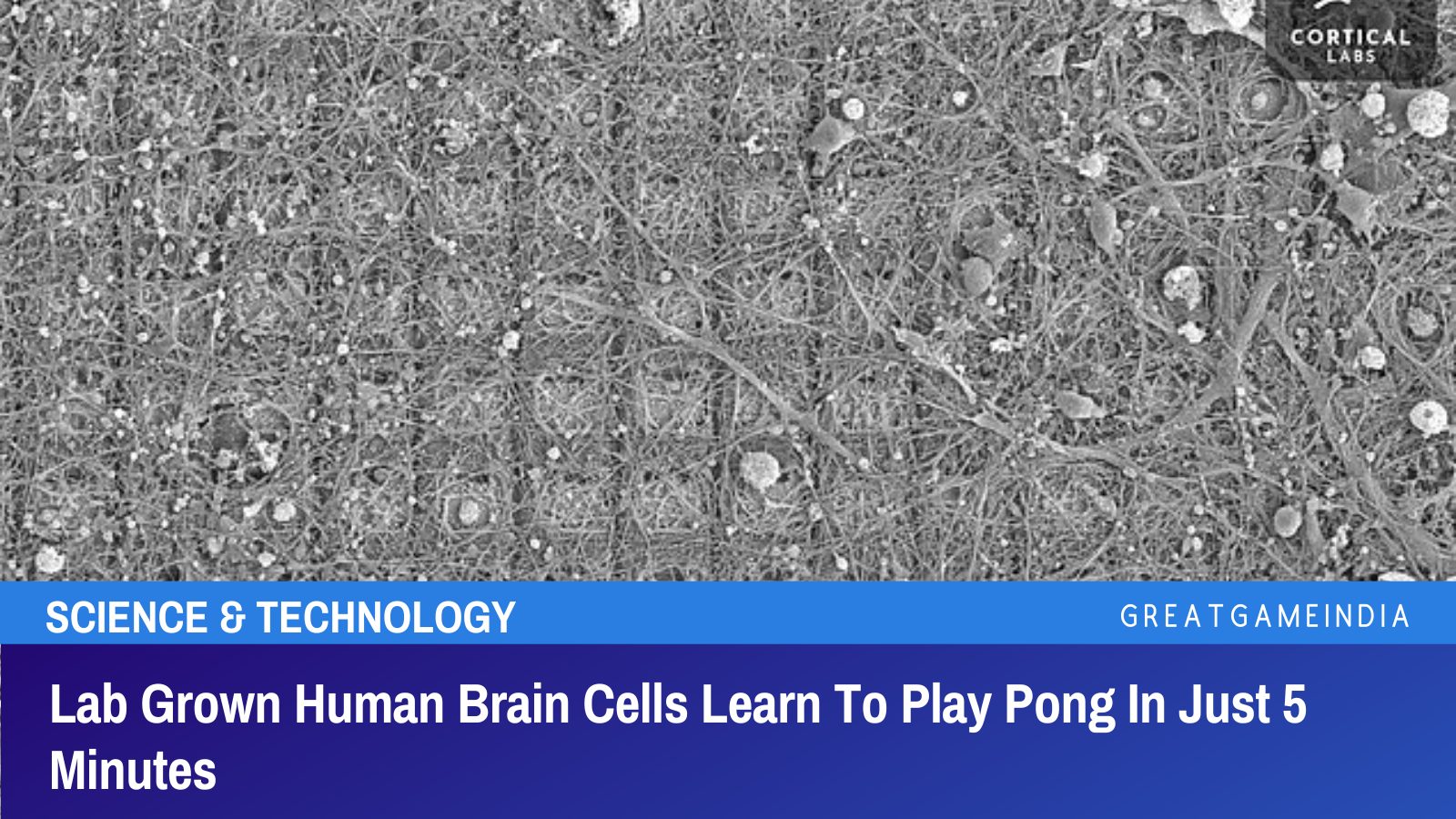 Lab Grown Human Brain Cells Learn To Play Pong In Just 5 Minutes