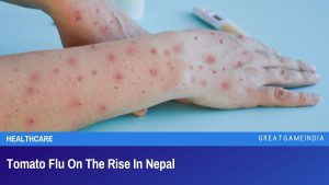 Tomato Flu On The Rise In Nepal