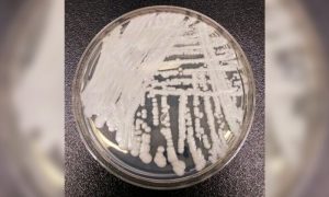 CDC Warns of Dangerous Fungal Infection Spreading Through US at Alarming Rate