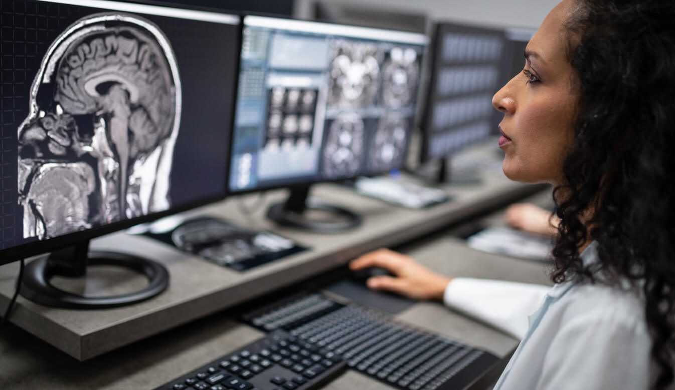 Will AI Replace Radiologists? - GreatGameInternational